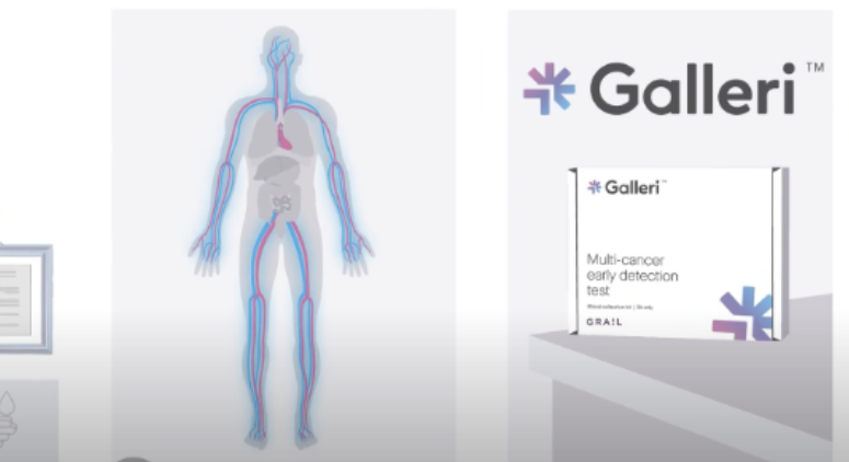 Galleri body image for Galleri Cancer Screening