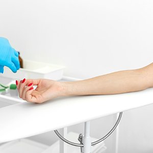 Therapeutic-Phlebotomy-Chicago